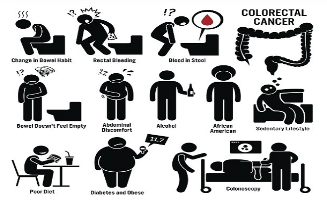 symptoms of Colon Cancer
