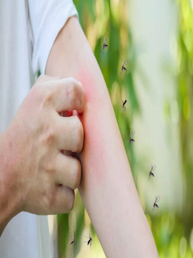 Rise In Dengue Cases: Here’S All You Need To Know About The Mosquito-Borne Disease